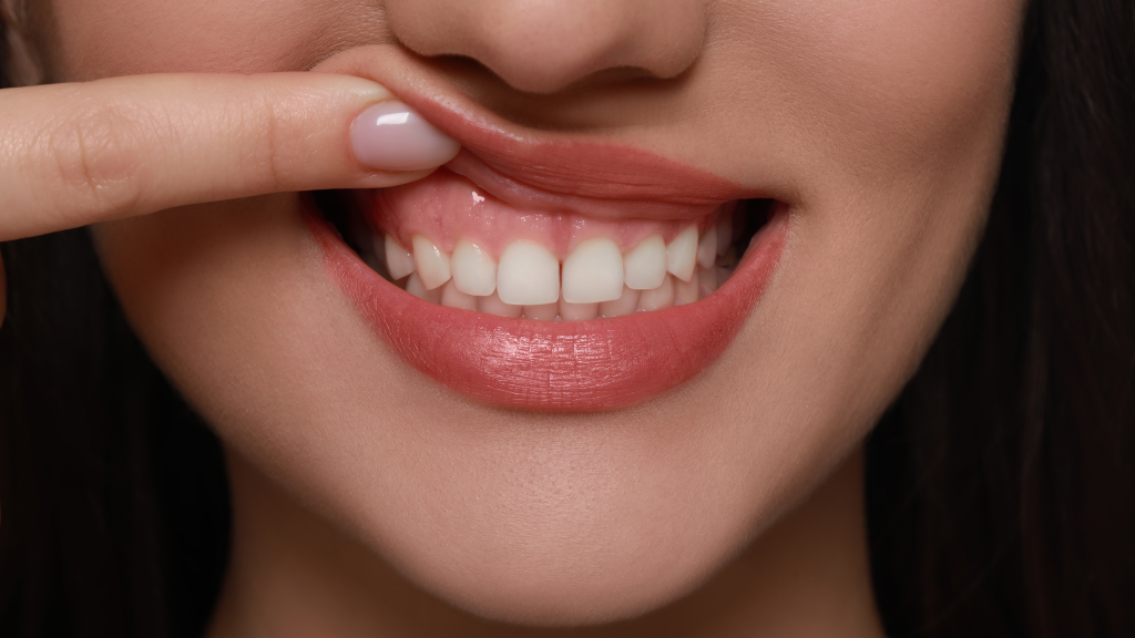 crown lengthening