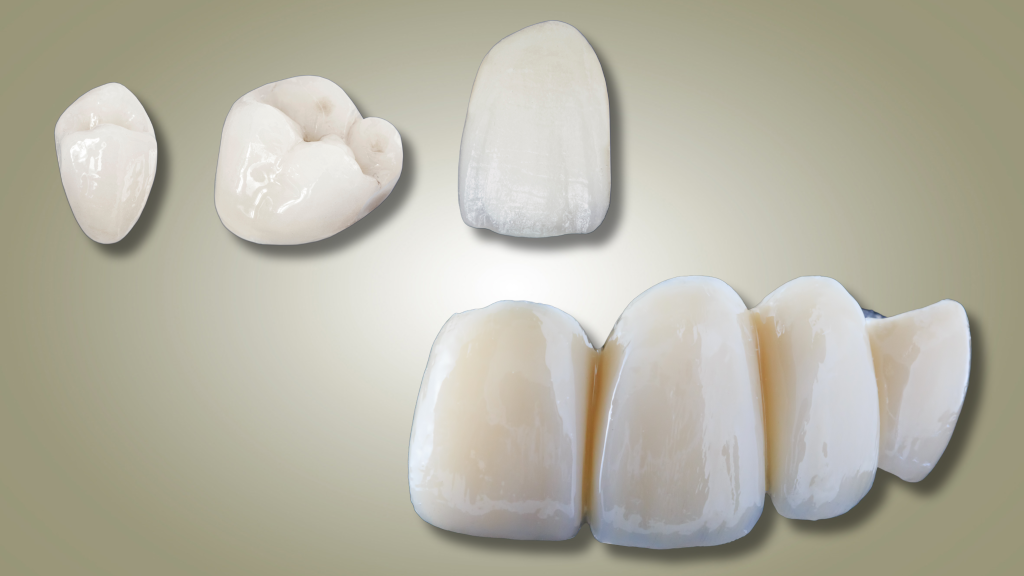 dental crown and bridges near you