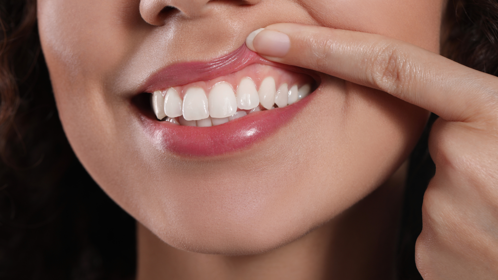 gum and bone grafting