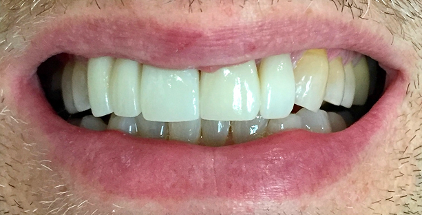 After image