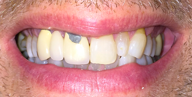 Before image